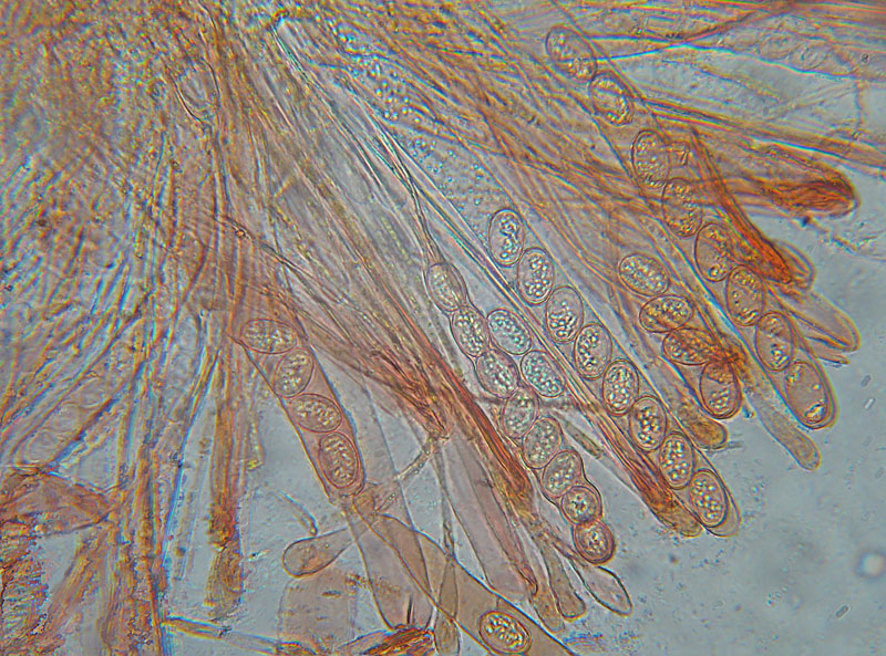 Mixomiceti con Scutellinia